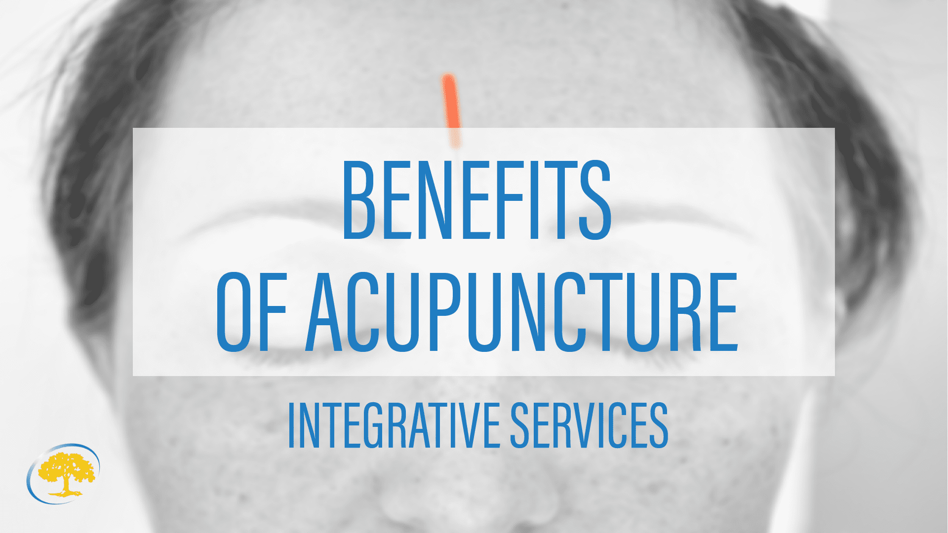 The Benefits of Acupuncture