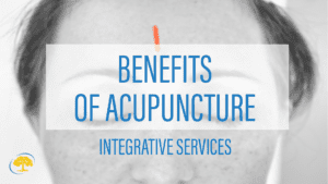 The Benefits of Acupuncture
